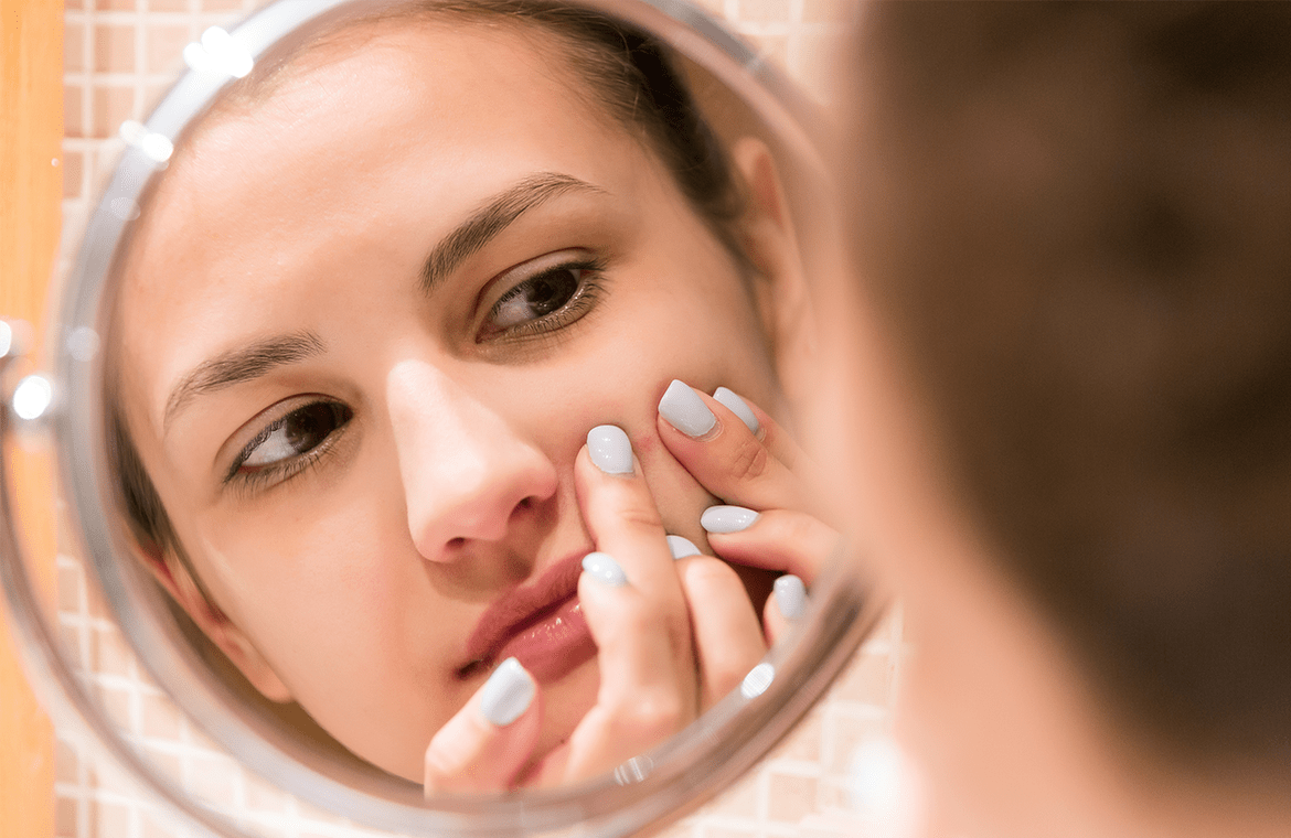 The Perfect Pimple Remedy For Your Pimples