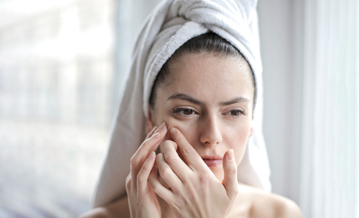 How to Combat Summer Breakouts: Tips and Tricks for Managing Pimples