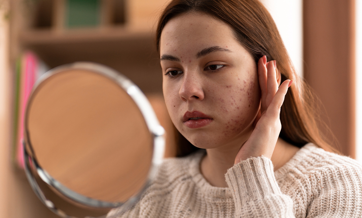 5 ways to repair a damaged skin barrier