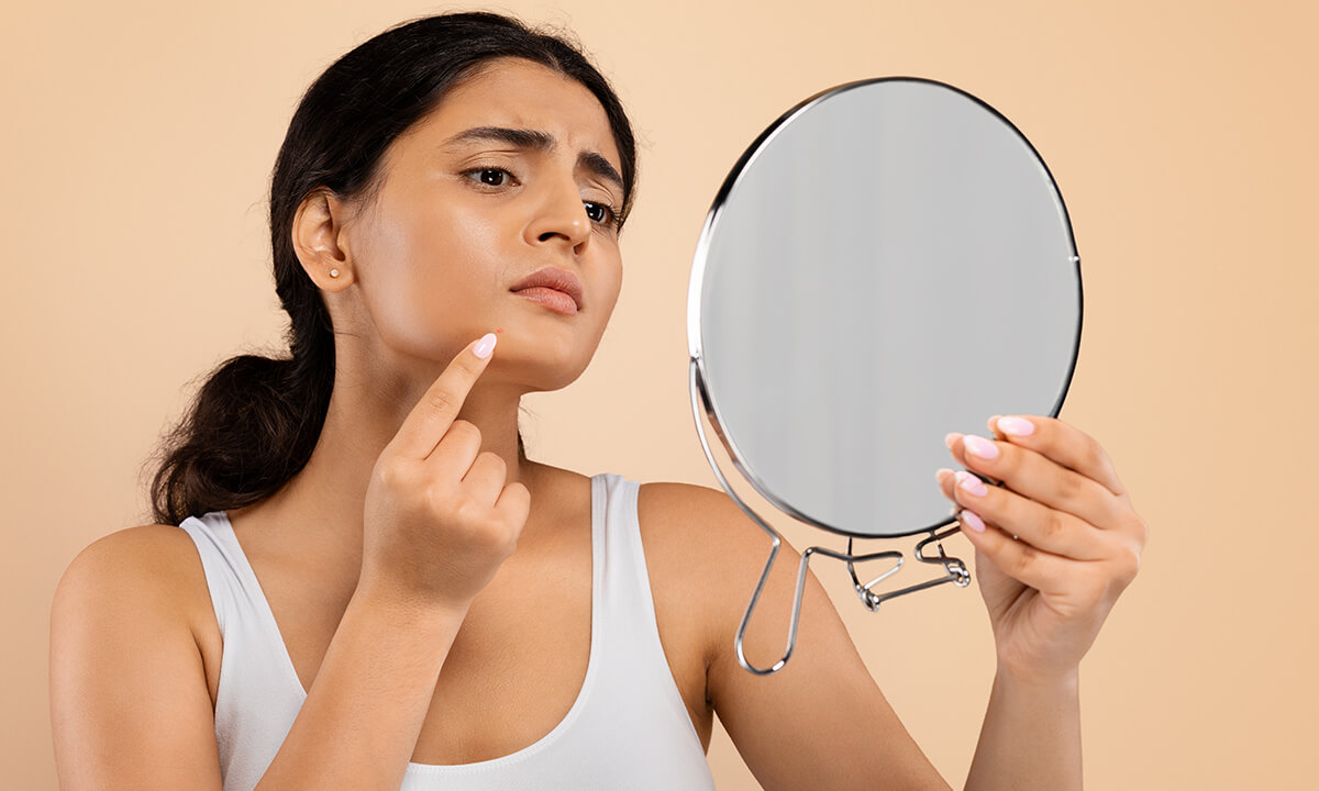 How to prevent pimples: Effective strategies for clear and healthy skin
