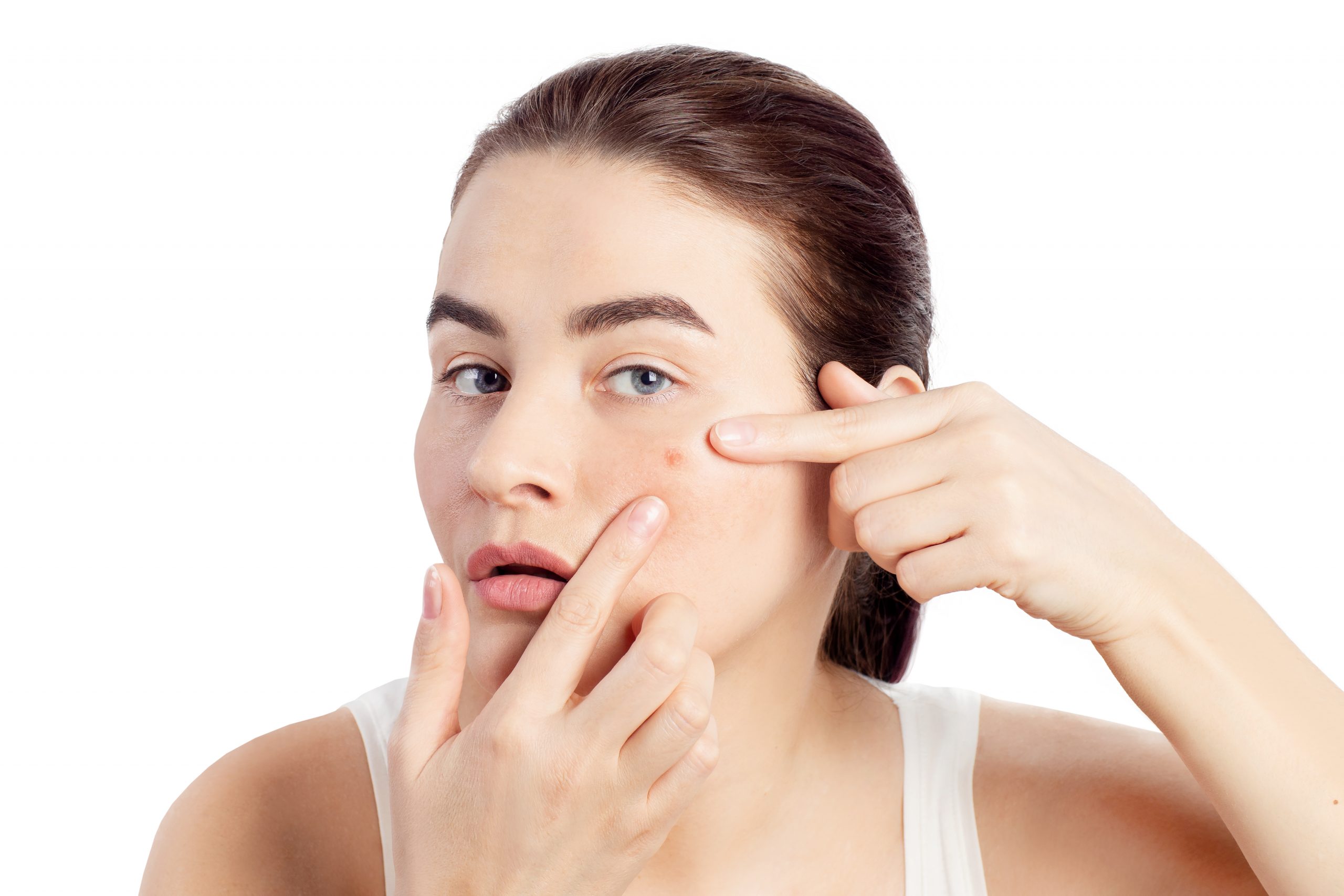 Step-by-Step Guide to Clean Pimple-Prone Skin